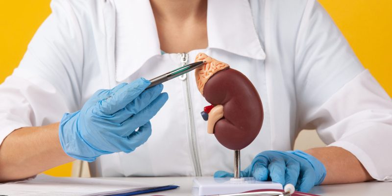 kidney transplant process