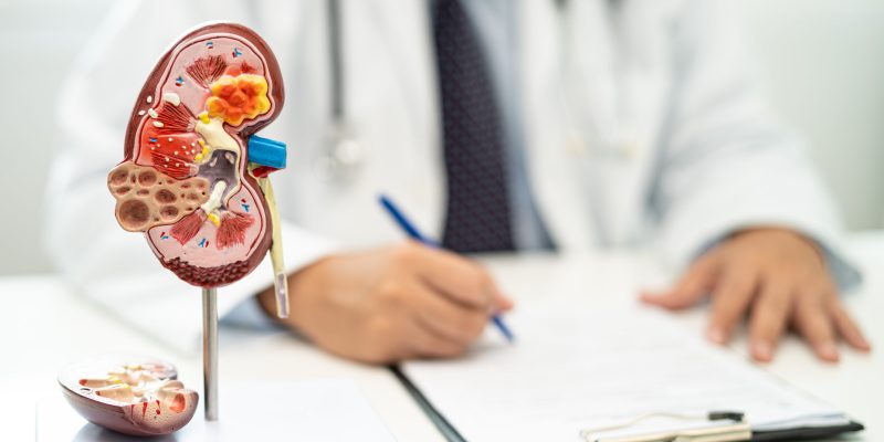 Kidney replacement surgery